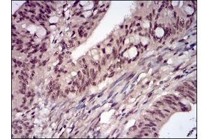 Immunohistochemistry (IHC) image for anti-Protein Phosphatase 1, Catalytic Subunit, beta Isoform (PPP1CB) (AA 174-327) antibody (ABIN5542354)