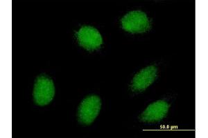 Immunofluorescence of purified MaxPab antibody to EXOSC1 on HeLa cell. (EXOSC1 Antikörper  (AA 1-195))