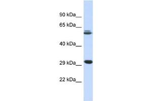 Host:  Rabbit  Target Name:  PCGF3  Sample Type:  Fetal Muscle lysates  Antibody Dilution:  1. (PCGF3 Antikörper  (Middle Region))