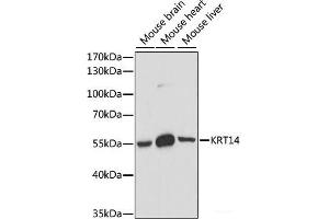 Western blot analysis of extracts of various cell lines using KRT14 Polyclonal Antibody at dilution of 1:1000. (KRT14 Antikörper)