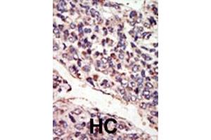 Immunohistochemistry (Paraffin-embedded Sections) (IHC (p)) image for anti-Neurotrophic tyrosine Kinase, Receptor, Type 3 (NTRK3) (AA 31-61), (N-Term) antibody (ABIN392066)