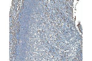 IHC analysis of SND1 using anti-SND1 antibody (ABIN7600526). (SND1 Antikörper  (AA 20-204))