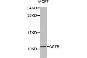 Western blot analysis of extracts of MCF7 cell lines, using CSTB antibody. (CSTB Antikörper  (AA 1-98))
