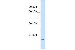 WB Suggested Anti-ASF1B Antibody Titration:  0. (ASF1B Antikörper  (Middle Region))
