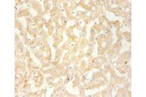 Immunohistochemistry of paraffin-embedded human liver using ABIN7146123 at dilution 1:100 (CXCL13 Antikörper  (AA 23-95))