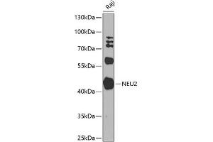 Western blot analysis of extracts of Raji cells, using NEU2 antibody (ABIN6129463, ABIN6144540, ABIN6144541 and ABIN6224161) at 1:1000 dilution. (NEU2 Antikörper  (AA 171-380))