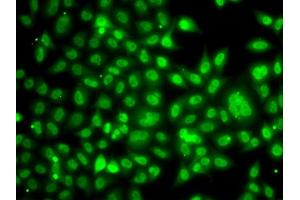 Immunofluorescence analysis of A549 cells using TBL1XR1 antibody. (TBL1XR1 Antikörper)