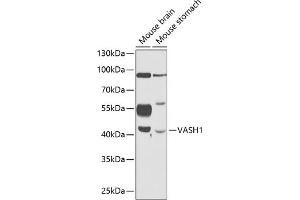 Western blot analysis of extracts of various cell lines, using V antibody (ABIN6128152, ABIN6150060, ABIN6150062 and ABIN6216248) at 1:1000 dilution.