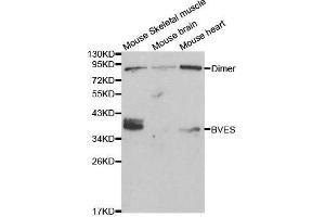 Western blot analysis of extracts of various cell lines, using BVES antibody. (BVES Antikörper  (AA 241-360))