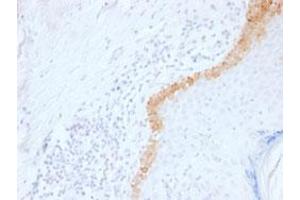 Immunohistochemical staining (Formalin-fixed paraffin-embedded sections) of human skin with KRT15 monoclonal antibody, clone LHK15 . (KRT15 Antikörper  (C-Term))