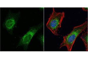 ICC/IF Image Dishevelled 3 antibody [N1N2], N-term detects Dishevelled 3 protein at cytoplasm by immunofluorescent analysis.