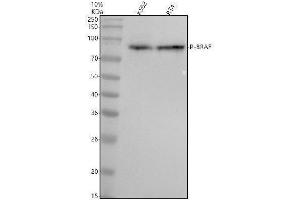 Western blot analysis of P-BRAF using anti-P-BRAF antibody (ABIN7603395).