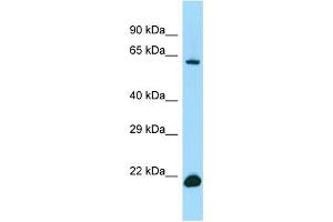 WB Suggested Anti-IRF2BP2 Antibody Titration: 1. (IRF2BP2 Antikörper  (C-Term))