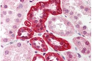 Human Kidney (formalin-fixed, paraffin-embedded) stained with SUMO1 antibody ABIN214521 at 5 ug/ml followed by biotinylated goat anti-rabbit IgG secondary antibody ABIN481713, alkaline phosphatase-streptavidin and chromogen. (SUMO1 Antikörper  (N-Term))