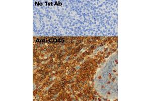 Immunohistochemistry (IHC) image for anti-Protein tyrosine Phosphatase, Receptor Type, C (PTPRC) (C-Term) antibody (ABIN6254211) (CD45 Antikörper  (C-Term))