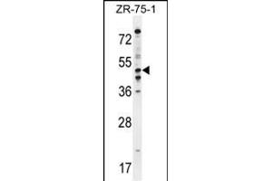 PDE7B Antibody (C-term) (ABIN654632 and ABIN2844328) western blot analysis in ZR-75-1 cell line lysates (35 μg/lane).