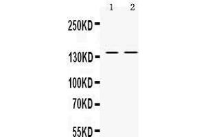 Observed bind size: 140KD (RENT1/UPF1 Antikörper  (Middle Region))