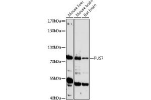Western blot analysis of extracts of various cell lines, using PUS7 antibody (ABIN7269739) at 1:1000 dilution. (PUS7 Antikörper  (AA 352-661))
