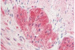 Human Small Intestine, Myenteric Plecus: Formalin-Fixed, Paraffin-Embedded (FFPE)