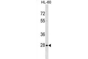 Western Blotting (WB) image for anti-Peptidylprolyl Isomerase (Cyclophilin)-Like 6 (PPIL6) antibody (ABIN2999694) (PPIL6 Antikörper)