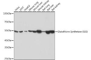 Western blot analysis of extracts of various cell lines, using Glutathione Synthetase (GSS) (GSS) Rabbit mAb (ABIN7267452) at 1:1000 dilution. (Glutathione Synthetase Antikörper)