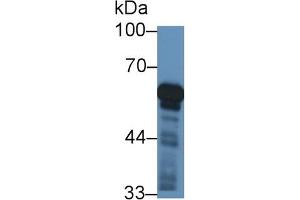 Detection of CYP11B1 in Rat Adrenal gland lysate using Polyclonal Antibody to Cytochrome P450 11B1 (CYP11B1) (CYP11B1 Antikörper  (AA 1-498))