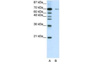 Western Blotting (WB) image for anti-Zinc Finger Protein 398 (ZNF398) antibody (ABIN2462005) (ZNF398 Antikörper)