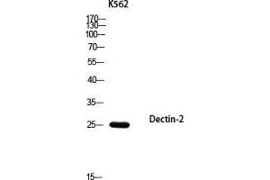 Western Blot (WB) analysis of K562 using Dectin-2 antibody. (C-Type Lectin Domain Family 6, Member A (CLEC6A) Antikörper)