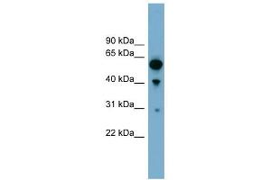ARHGAP15 antibody used at 1 ug/ml to detect target protein. (ARHGAP15 Antikörper  (Middle Region))