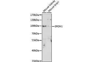 Western blot analysis of extracts of various cell lines, using SPON1 antibody (ABIN7270552) at 1:1000 dilution. (SPON1 Antikörper  (AA 29-300))
