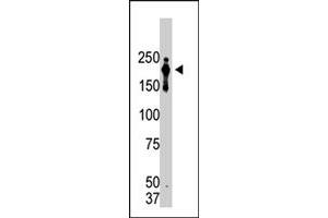 Western blot analysis of PRDM2 monoclonal antibody, clone 33AT1045  in lysate from transformed cells. (PRDM2 Antikörper  (AA 1-347))