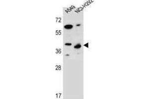 Western Blotting (WB) image for anti-Protein Phosphatase 1, Regulatory Subunit 42 (PPP1R42) antibody (ABIN2996758) (PPP1R42 Antikörper)