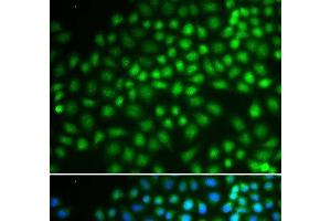 Immunofluorescence analysis of HeLa cells using SMARCA5 Polyclonal Antibody (SMARCA5 Antikörper)