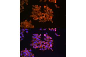 Immunofluorescence analysis of HeLa cells using ETF1 Rabbit pAb (ABIN6129660, ABIN6140313, ABIN6140314 and ABIN6221622) at dilution of 1:100 (40x lens).