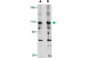 Western blot analysis of DLGAP2 in L1210 cell lysate with DLGAP2 polyclonal antibody  at (A) 0. (DLGAP2 Antikörper  (Internal Region))