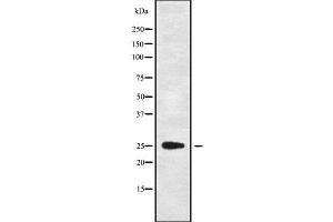 Western blot analysis of C1QL4 using HepG2 whole cell lysates (C1QL4 Antikörper  (Internal Region))