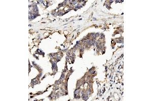 IHC analysis of Ribonuclease Inhibitor/RNH1 using anti-Ribonuclease Inhibitor/RNH1 antibody (ABIN7603117).