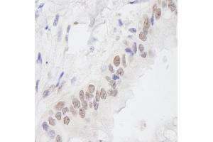 Immunohistochemistry (IHC) image for anti-Chromosome 11 Open Reading Frame 30 (C11orf30) (C-Term) antibody (ABIN7448552) (EMSY Antikörper  (C-Term))