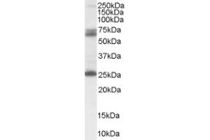 Image no. 1 for anti-Glutamate Decarboxylase 2 (Pancreatic Islets and Brain, 65kDa) (GAD2) (Internal Region) antibody (ABIN374550)