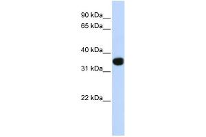 WB Suggested Anti-TLX1 Antibody Titration:  0. (TLX1 Antikörper  (Middle Region))