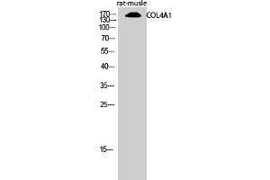Western Blotting (WB) image for anti-Collagen, Type IV, alpha 1 (COL4A1) (N-Term) antibody (ABIN5956219) (COL4A1 Antikörper  (N-Term))