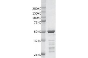 Recombinant MLL / HRX - SET protein gel.
