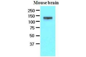 The extracts of mouse brain (50 ug) were resolved by SDS-PAGE, transferred to nitrocellulose membrane and probed with anti-human EphA2 (1:500). (EPH Receptor A2 Antikörper  (AA 559-976))