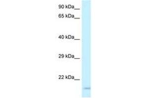 Image no. 1 for anti-Glycoprotein IX (Platelet) (GP9) (AA 61-110) antibody (ABIN6747603) (CD42a Antikörper  (AA 61-110))