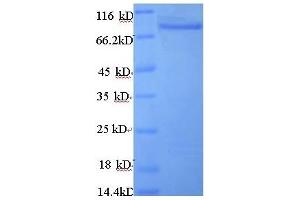 Angiopoietin-Like 4 (ANGPTL4) (AA 28-403), (partial) protein (GST tag) (ANGPTL4 Protein (AA 28-403, partial) (GST tag))
