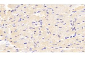 Detection of VAV1 in Mouse Cardiac Muscle Tissue using Polyclonal Antibody to Vav 1 Oncogene (VAV1) (VAV1 Antikörper  (AA 565-795))