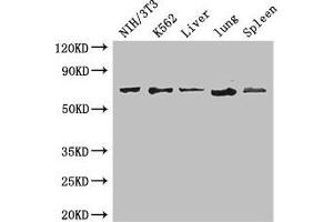 Western Blot Positive WB detected in: NIH/3T3 whole cell lysate, K562 whole cell lysate, Mouse liver tissue, Mouse lung tissue, Mouse spleen tissue All lanes: IL23R antibody at 3. (IL23R Antikörper  (AA 15-125))