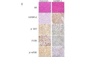 IGFBPL1 inhibits the PI3K-AKT signaling pathway and suppresses human ESCC cell xenograft growth in mice. (IGFBPL1 Antikörper  (AA 201-278))