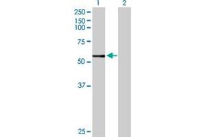 Western Blotting (WB) image for anti-Cytochrome P450, Family 3, Subfamily A, Polypeptide 7 (CYP3A7) (AA 1-503) antibody (ABIN514828)