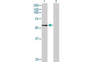 Western Blot analysis of CYP3A7 expression in transfected 293T cell line by CYP3A7 MaxPab polyclonal antibody. (CYP3A7 Antikörper  (AA 1-503))